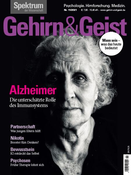 Alzheimer: Die unterschätzte Rolle des Immunsystems – Gehirn&Geist 2021 11 – Hörbuch